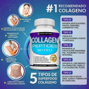 PAGA 1, LLEVATE 2 - Péptidos de colágeno TopLux™  Nutrición
